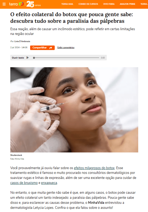 O efeito colateral do botox que pouca gente sabe: descubra tudo sobre a paralisia das pálpebras